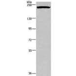 PRDM2 Antibody from Signalway Antibody (37691) - Antibodies.com
