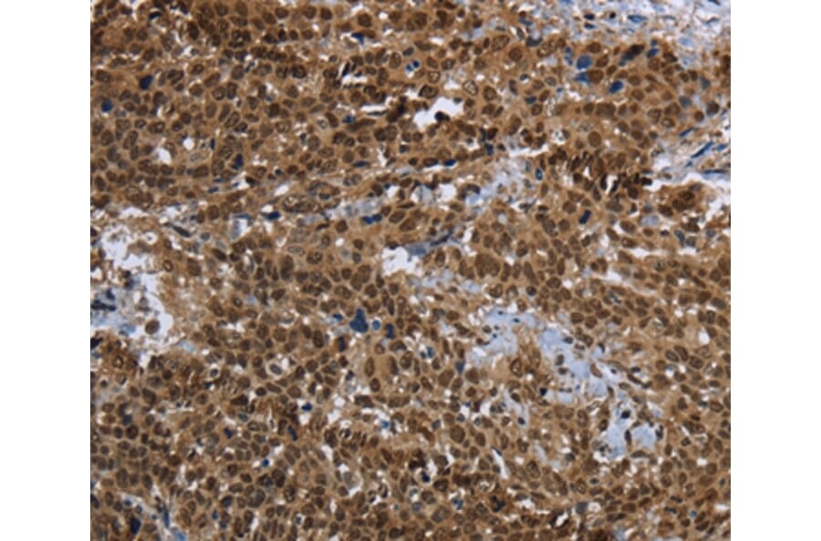 Immunohistochemistry - PRDM2 Antibody from Signalway Antibody (37691) - Antibodies.com