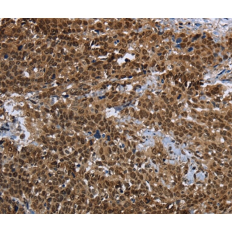 Immunohistochemistry - PRDM2 Antibody from Signalway Antibody (37691) - Antibodies.com