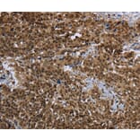 Immunohistochemistry - PRDM2 Antibody from Signalway Antibody (37691) - Antibodies.com