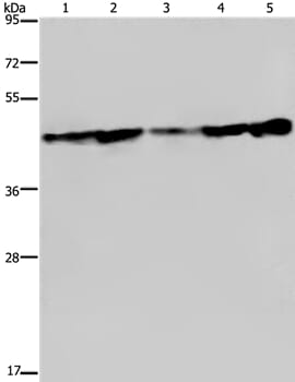Gel: 8% SDS-PAGE Lysates (from left to right): Human fetal liver tissue, HT-29 and HUVEC cell, MCF-7 cell and human hepatocellular carcinoma tissue Amount of lysate: 40ug per lane Primary antibody: 1/300 dilution Secondary antibody dilution: 1/8000 Exposure time: 10 seconds