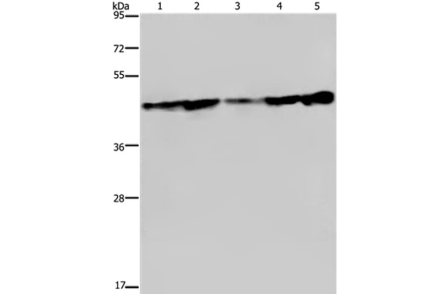 CERS4 Antibody from Signalway Antibody (37696) - Antibodies.com