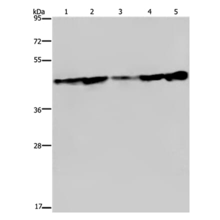 CERS4 Antibody from Signalway Antibody (37696) - Antibodies.com