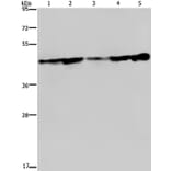 CERS4 Antibody from Signalway Antibody (37696) - Antibodies.com
