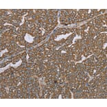 Immunohistochemistry - CERS4 Antibody from Signalway Antibody (37696) - Antibodies.com