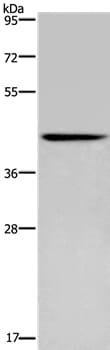 Gel: 8% SDS-PAGE Lysates (from left to right): Human fetal brain tissue Amount of lysate: 40ug per lane Primary antibody: 1/350 dilution Secondary antibody dilution: 1/8000 Exposure time: 5 minutes