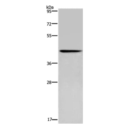 CERS5 Antibody from Signalway Antibody (37697) - Antibodies.com