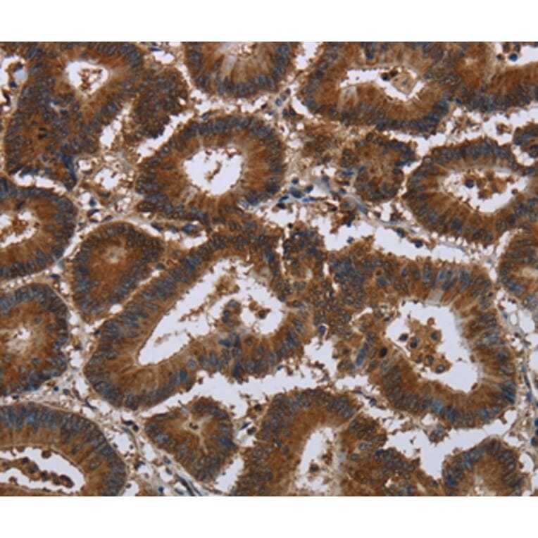 Immunohistochemistry - CERS5 Antibody from Signalway Antibody (37697) - Antibodies.com