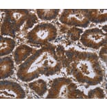 Immunohistochemistry - CERS5 Antibody from Signalway Antibody (37697) - Antibodies.com