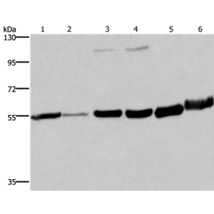 MCHR1 Antibody from Signalway Antibody (37720) - Antibodies.com
