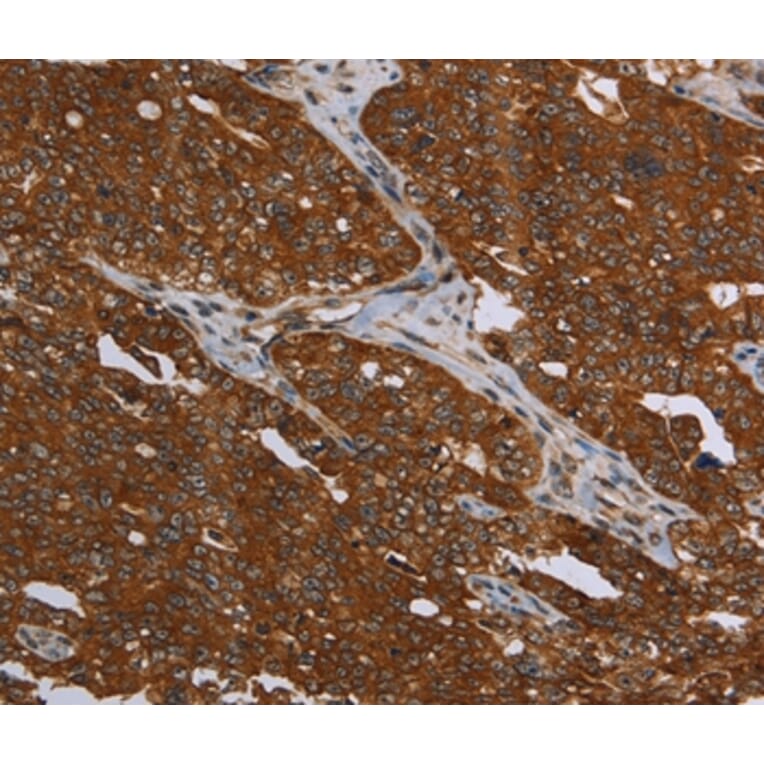 Immunohistochemistry - MCHR1 Antibody from Signalway Antibody (37720) - Antibodies.com