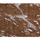 Immunohistochemistry - MCHR1 Antibody from Signalway Antibody (37720) - Antibodies.com