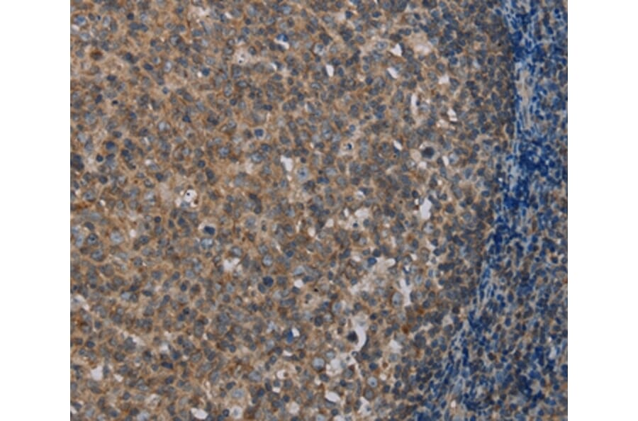 Immunohistochemistry - MMP20 Antibody from Signalway Antibody (37734) - Antibodies.com