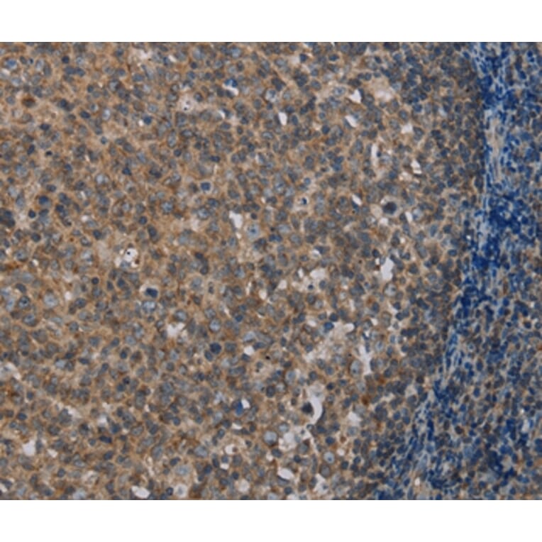 Immunohistochemistry - MMP20 Antibody from Signalway Antibody (37734) - Antibodies.com