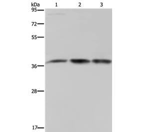 CAB39 Antibody from Signalway Antibody (37736) - Antibodies.com