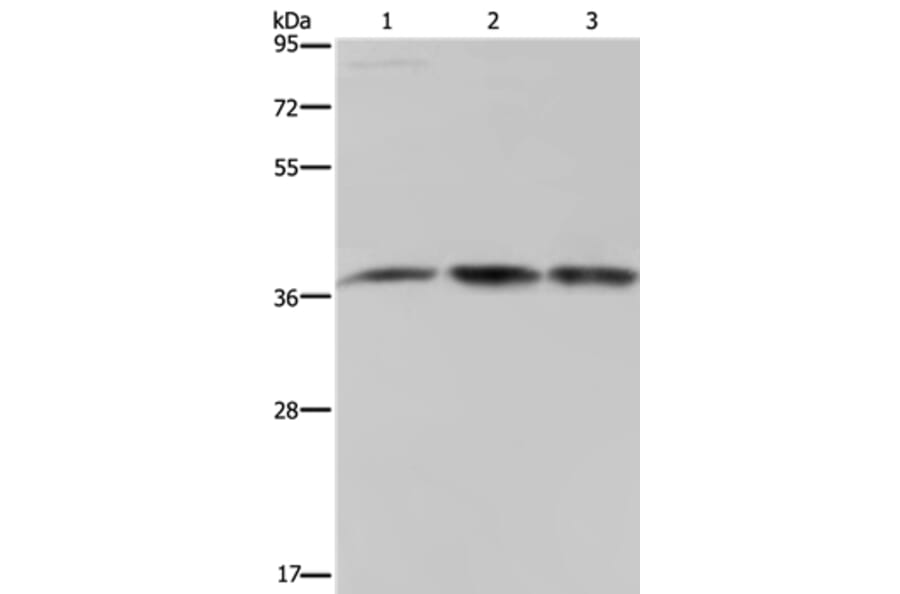 CAB39 Antibody from Signalway Antibody (37736) - Antibodies.com