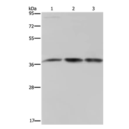 CAB39 Antibody from Signalway Antibody (37736) - Antibodies.com