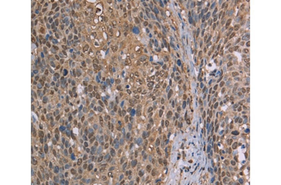 Immunohistochemistry - CAB39 Antibody from Signalway Antibody (37736) - Antibodies.com
