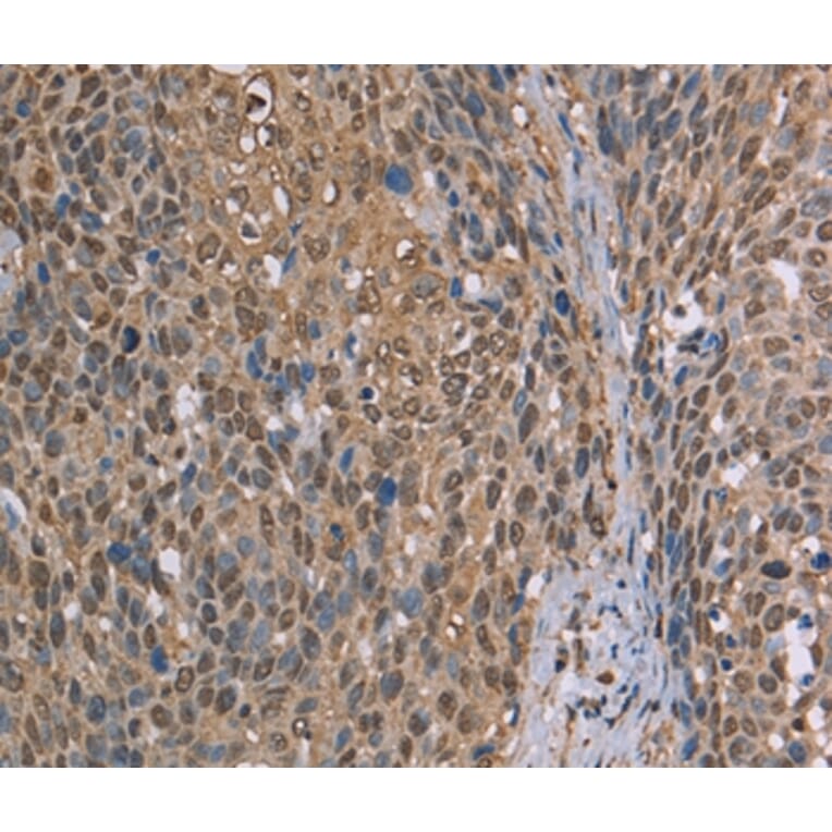 Immunohistochemistry - CAB39 Antibody from Signalway Antibody (37736) - Antibodies.com