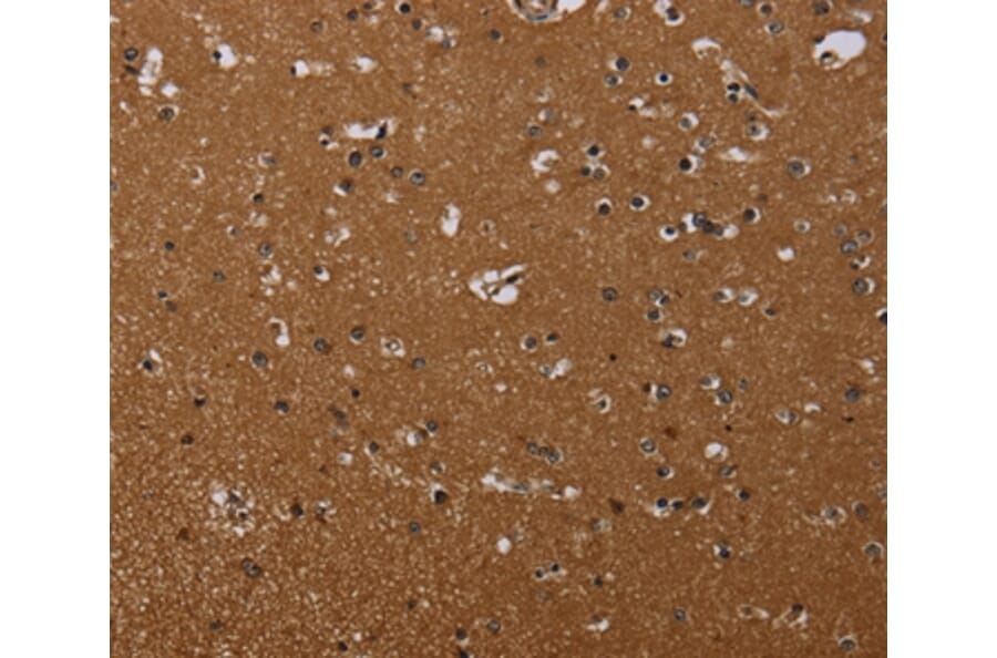 Immunohistochemistry - MOB1A Antibody from Signalway Antibody (37737) - Antibodies.com