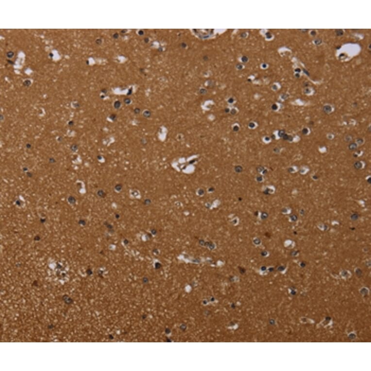 Immunohistochemistry - MOB1A Antibody from Signalway Antibody (37737) - Antibodies.com