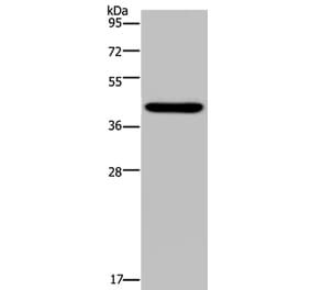 NPHS2 Antibody from Signalway Antibody (37775) - Antibodies.com