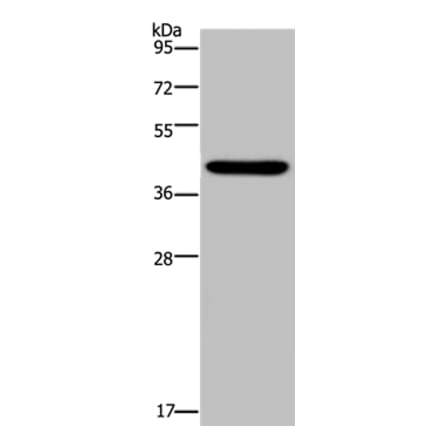 NPHS2 Antibody from Signalway Antibody (37775) - Antibodies.com