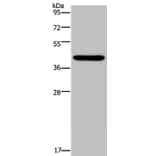 NPHS2 Antibody from Signalway Antibody (37775) - Antibodies.com