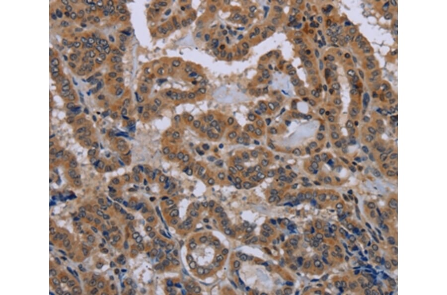 Immunohistochemistry - NPHS2 Antibody from Signalway Antibody (37775) - Antibodies.com