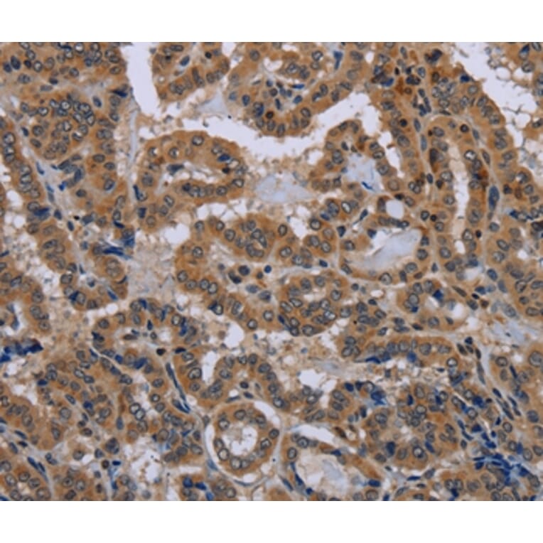 Immunohistochemistry - NPHS2 Antibody from Signalway Antibody (37775) - Antibodies.com