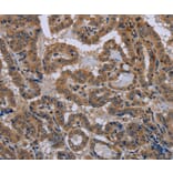 Immunohistochemistry - NPHS2 Antibody from Signalway Antibody (37775) - Antibodies.com