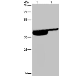 P2RX3 Antibody from Signalway Antibody (37787) - Antibodies.com
