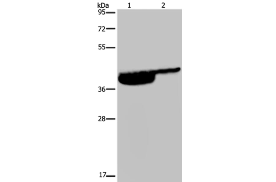 P2RX3 Antibody from Signalway Antibody (37787) - Antibodies.com