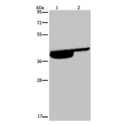 P2RX3 Antibody from Signalway Antibody (37787) - Antibodies.com