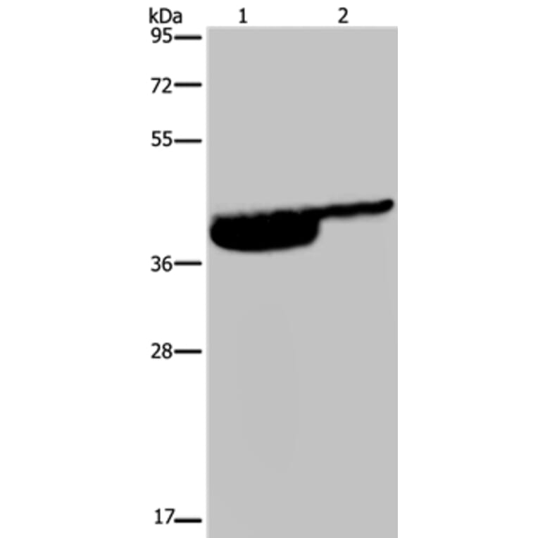 P2RX3 Antibody from Signalway Antibody (37787) - Antibodies.com