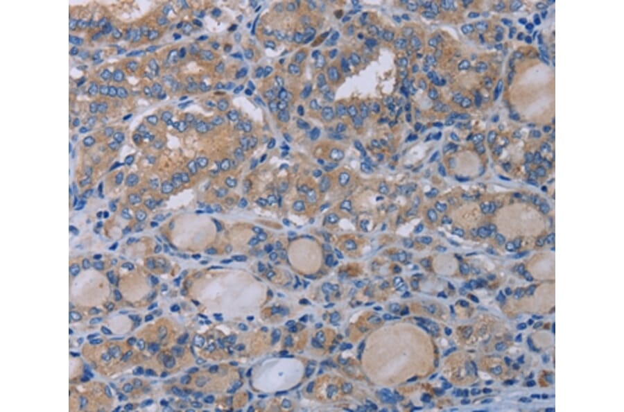 Immunohistochemistry - P2RX3 Antibody from Signalway Antibody (37787) - Antibodies.com