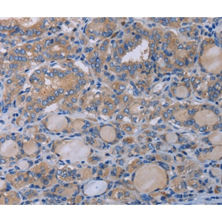 Immunohistochemistry - P2RX3 Antibody from Signalway Antibody (37787) - Antibodies.com