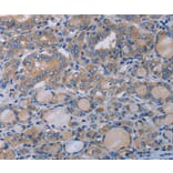 Immunohistochemistry - P2RX3 Antibody from Signalway Antibody (37787) - Antibodies.com