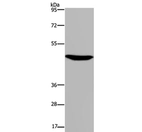 P2RX2 Antibody from Signalway Antibody (37788) - Antibodies.com