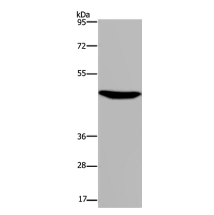 P2RX2 Antibody from Signalway Antibody (37788) - Antibodies.com