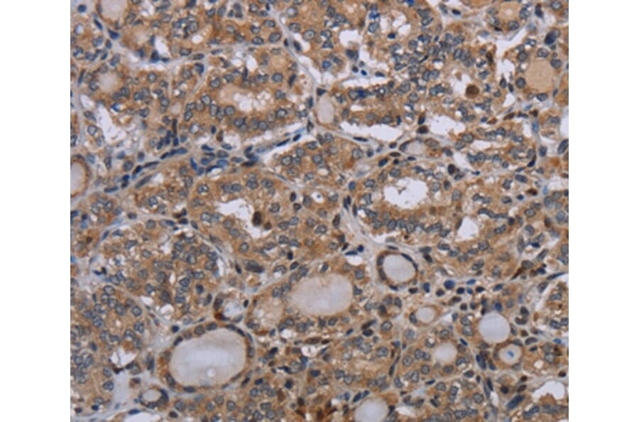 Immunohistochemistry - P2RX2 Antibody from Signalway Antibody (37788) - Antibodies.com