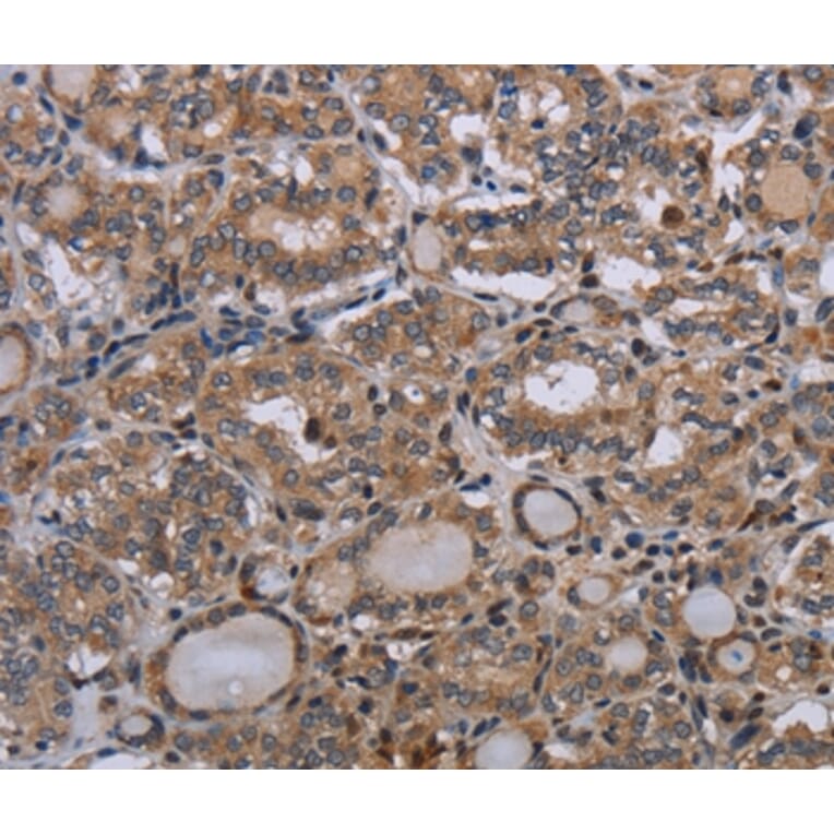 Immunohistochemistry - P2RX2 Antibody from Signalway Antibody (37788) - Antibodies.com