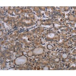 Immunohistochemistry - P2RX2 Antibody from Signalway Antibody (37788) - Antibodies.com