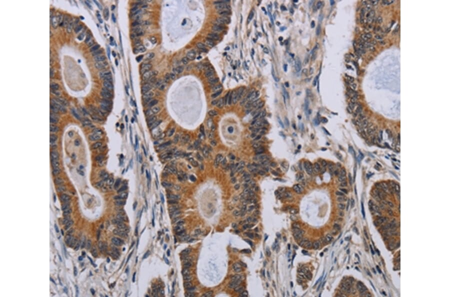 Immunohistochemistry - PARP8 Antibody from Signalway Antibody (37798) - Antibodies.com