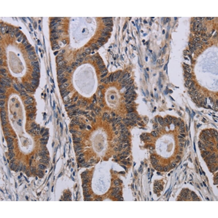 Immunohistochemistry - PARP8 Antibody from Signalway Antibody (37798) - Antibodies.com