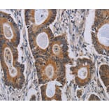Immunohistochemistry - PARP8 Antibody from Signalway Antibody (37798) - Antibodies.com