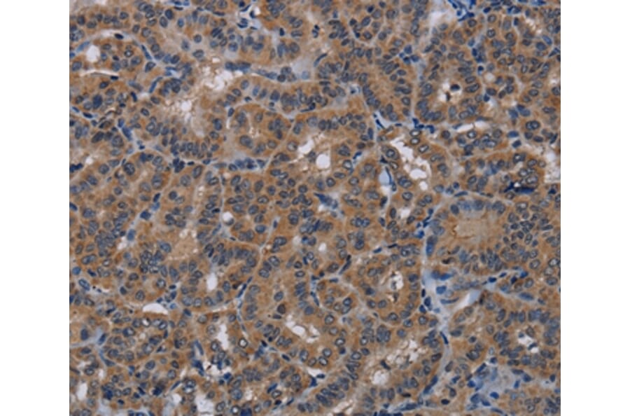 Immunohistochemistry - PDE4A Antibody from Signalway Antibody (37809) - Antibodies.com
