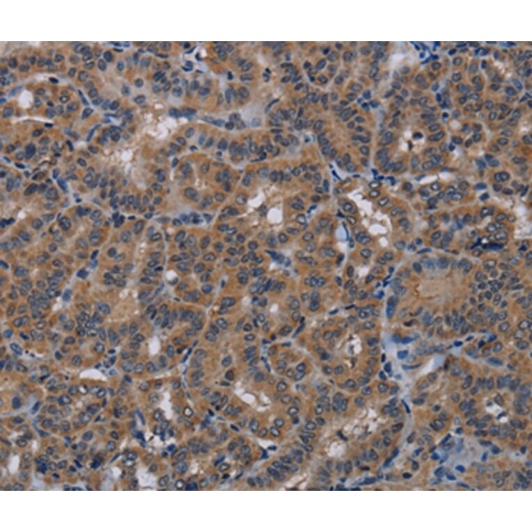 Immunohistochemistry - PDE4A Antibody from Signalway Antibody (37809) - Antibodies.com