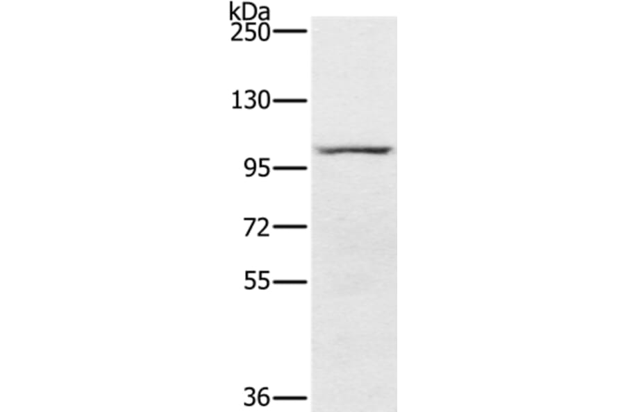 PDE5A Antibody from Signalway Antibody (37810) - Antibodies.com
