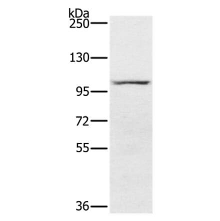 PDE5A Antibody from Signalway Antibody (37810) - Antibodies.com
